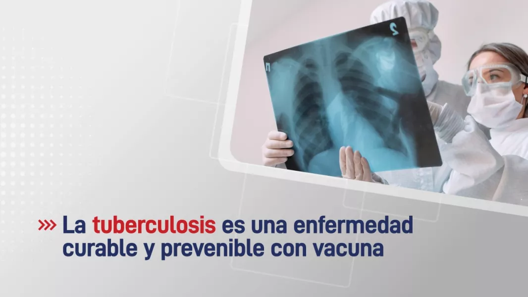 104497-la-tuberculosis-es-una-enfermedad-curable-y-prevenible-con-vacuna