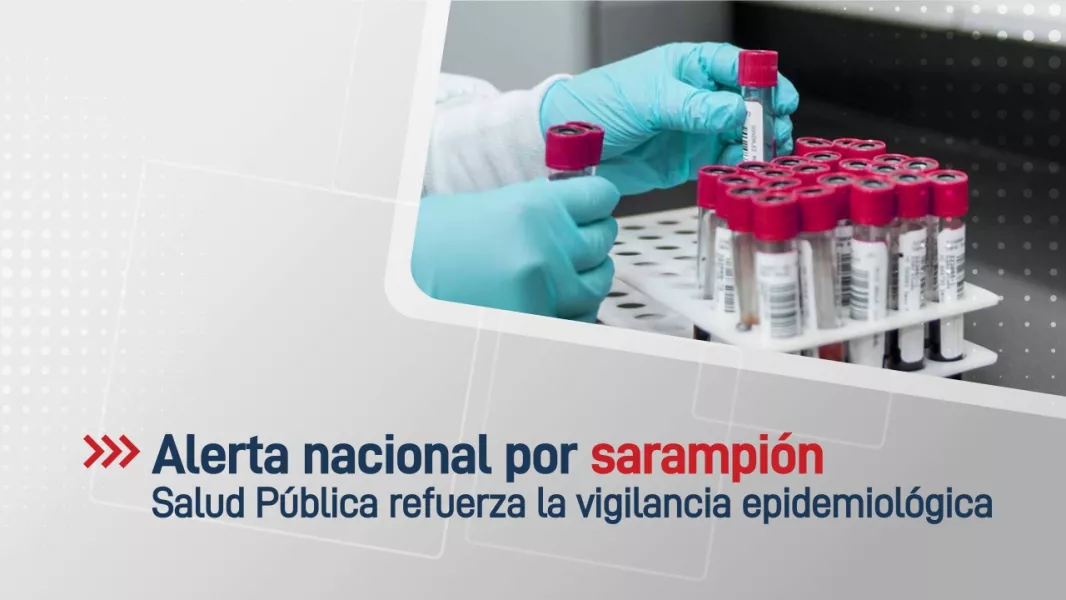 105090-salud-publica-refuerza-la-vigilancia-epidemiologica-ante-la-alerta-nacional-por-sarampion