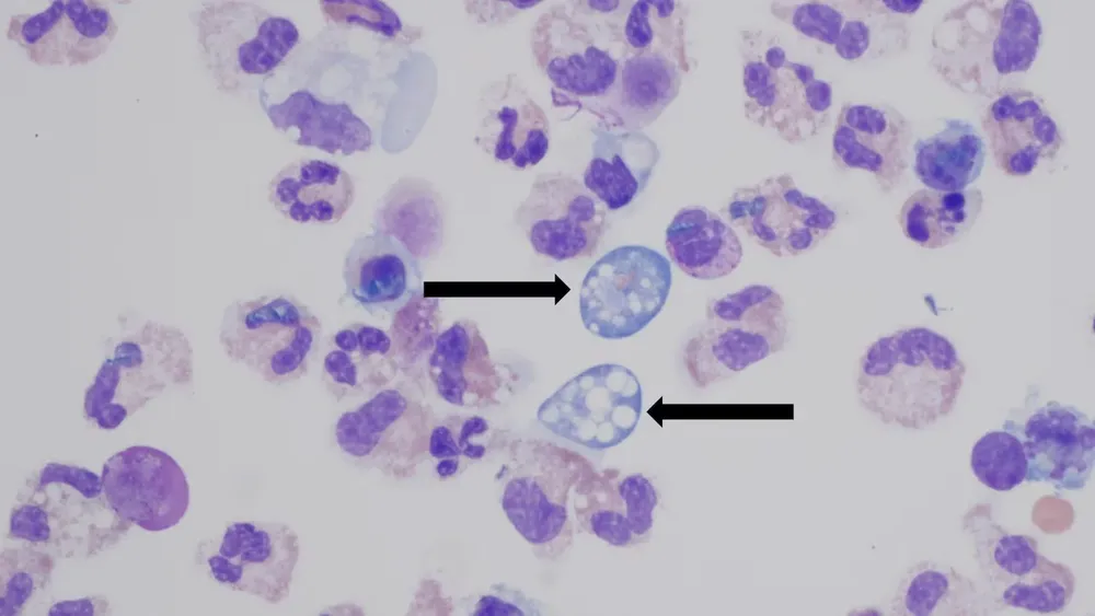 lbacteria-naegleria