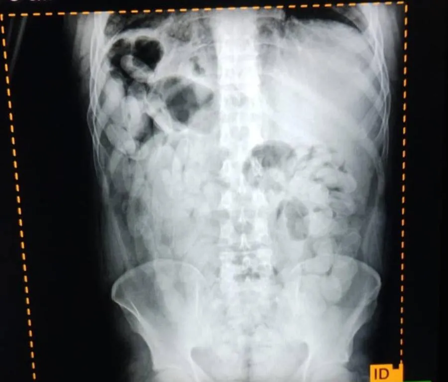 tucuman-_capsuleros_detenidos-_cocaina-_omnibus_3