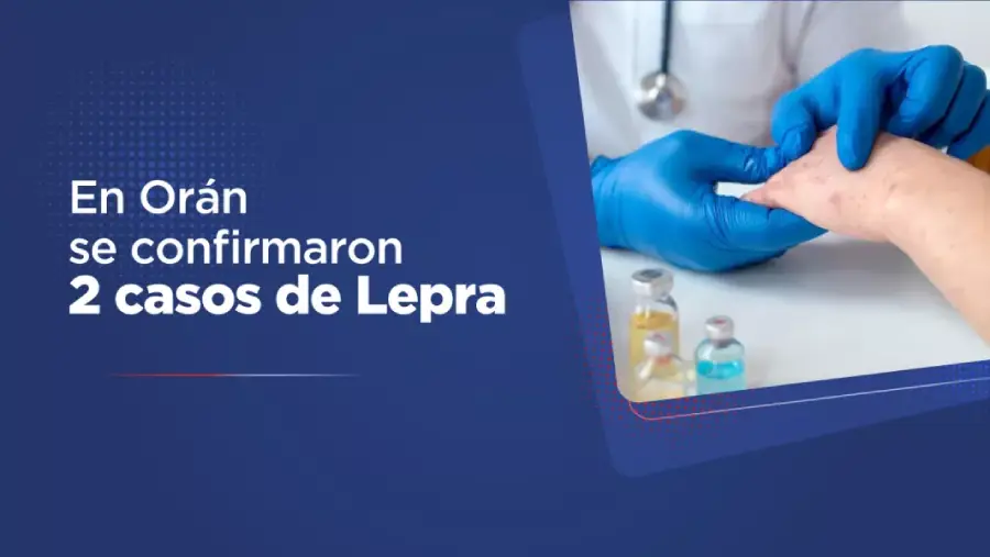 106307-en-el-departamento-oran-se-confirmaron-dos-casos-de-lepra (1)