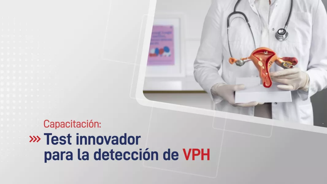 100716-capacitaran-a-profesionales-de-la-salud-sobre-un-test-innovador-para-la-deteccion-de-vph