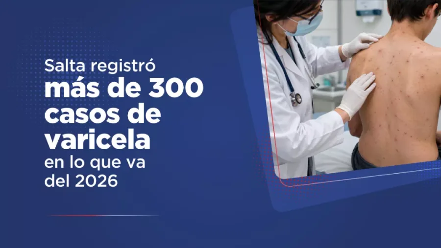 109895-suman-mas-de-300-los-casos-confirmados-de-varicela-en-salta