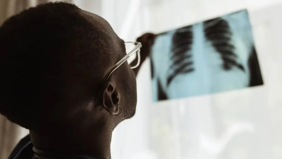 tuberculosis-1jpg